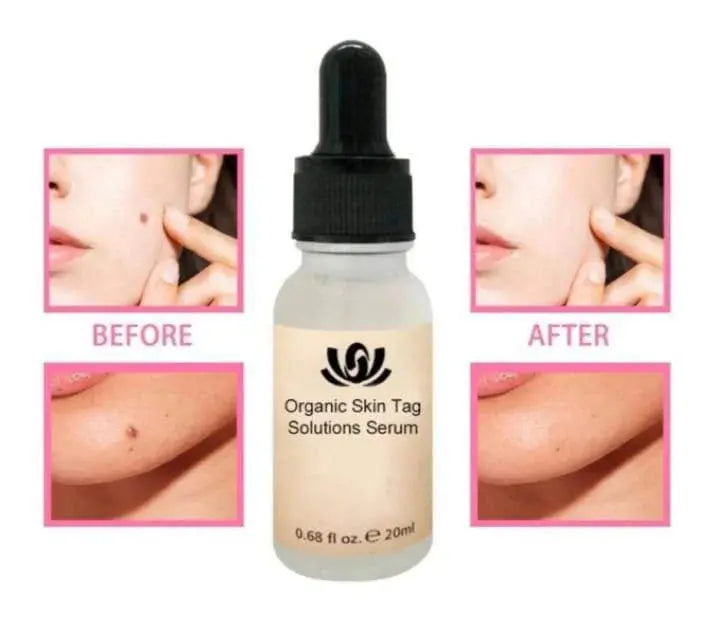 NATURAL SPOTS FREE SERUM Pameza