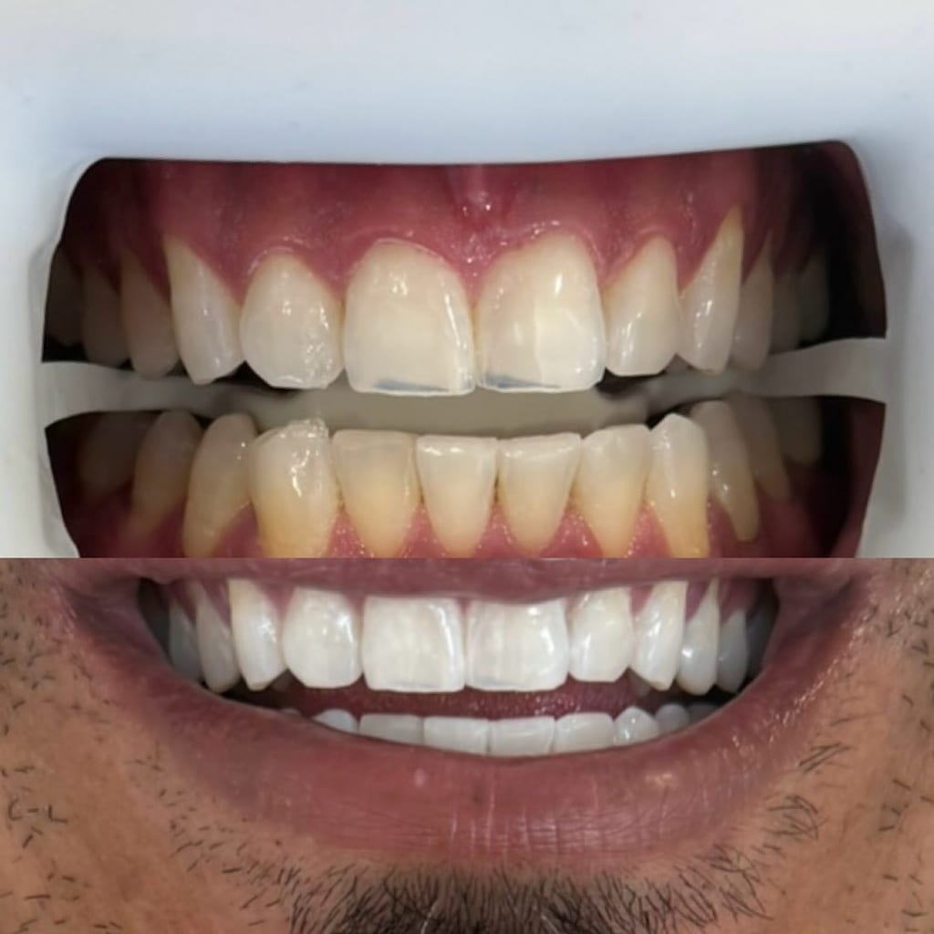 Unibroc Tooth Paste