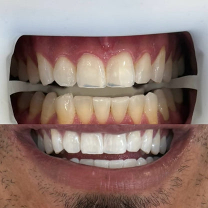 Unibroc Tooth Paste