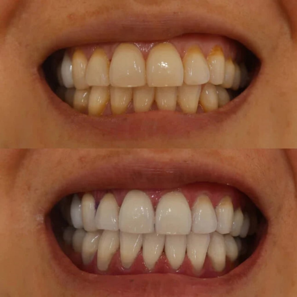 Unibroc Tooth Paste