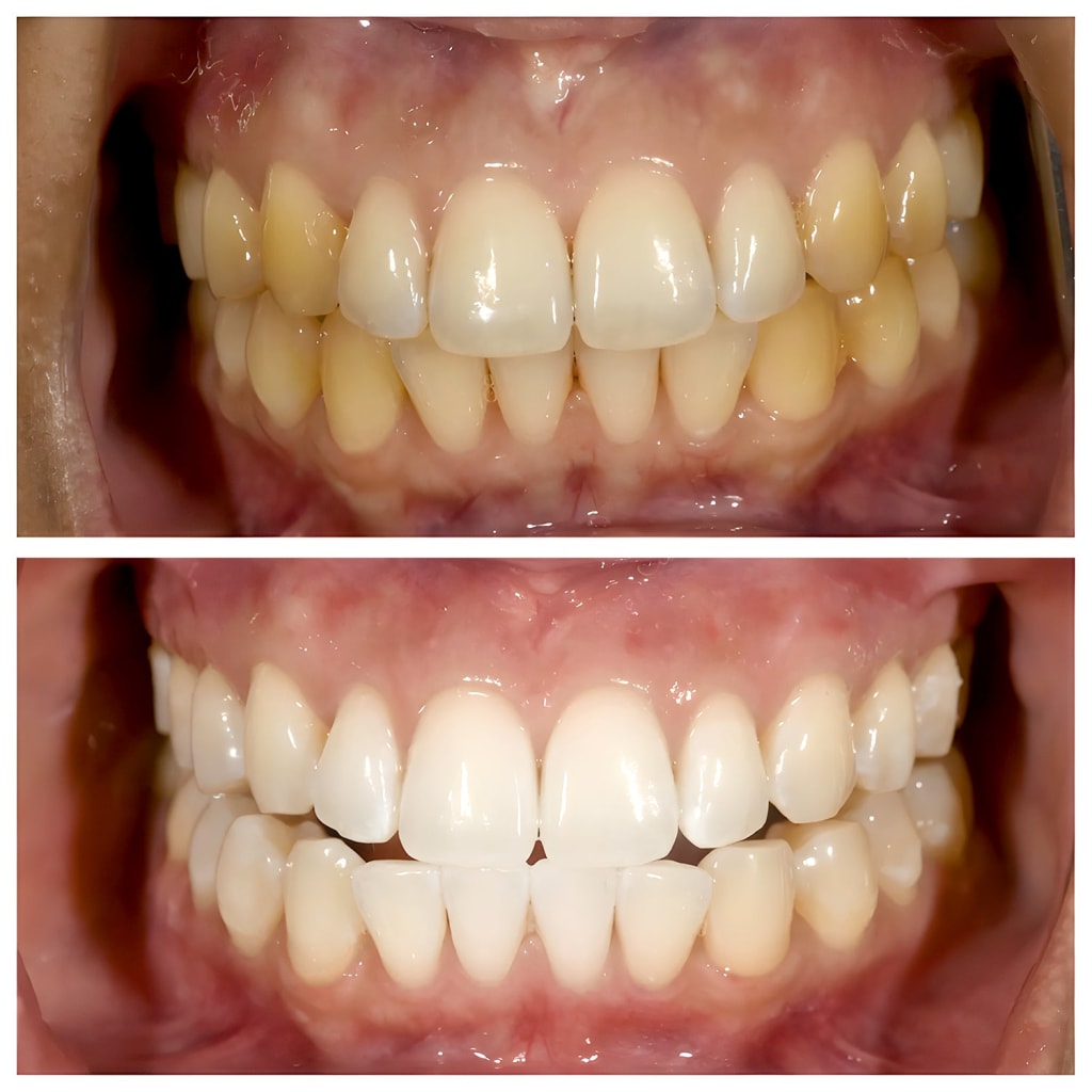 Unibroc Tooth Paste