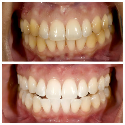 Unibroc Tooth Paste