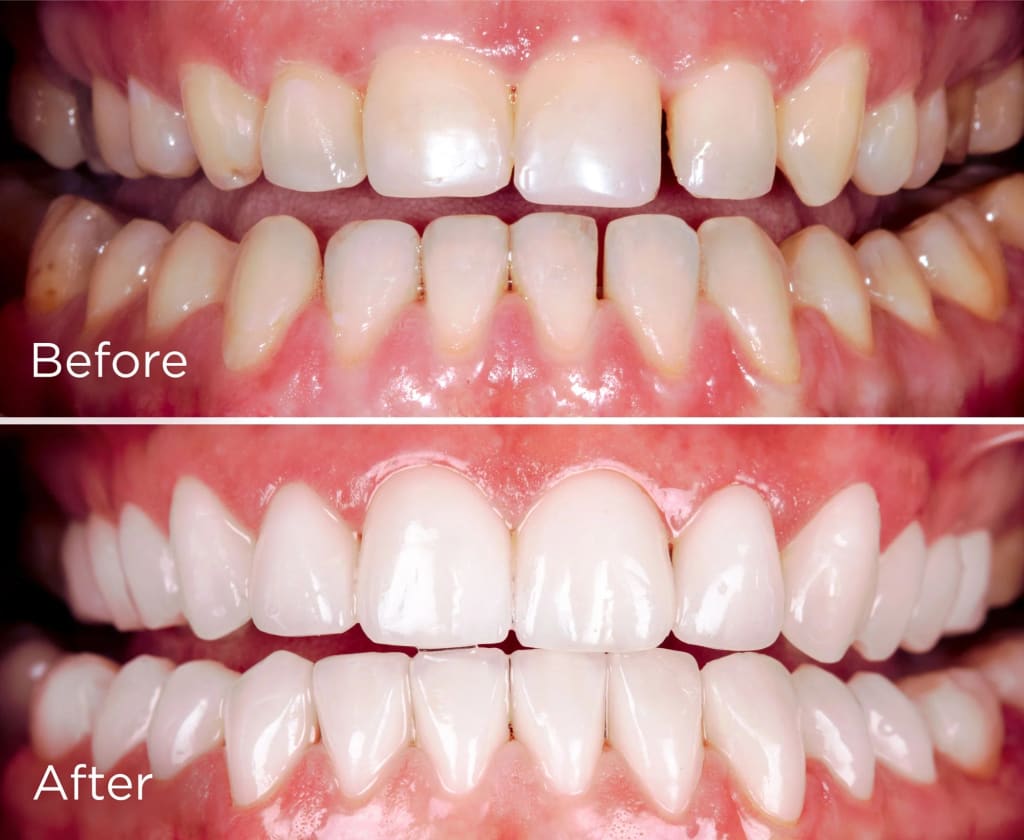 Unibroc Tooth Paste
